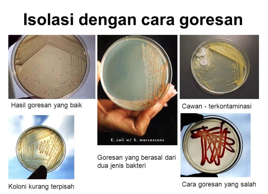 5 Teknik Isolasi Bakteri