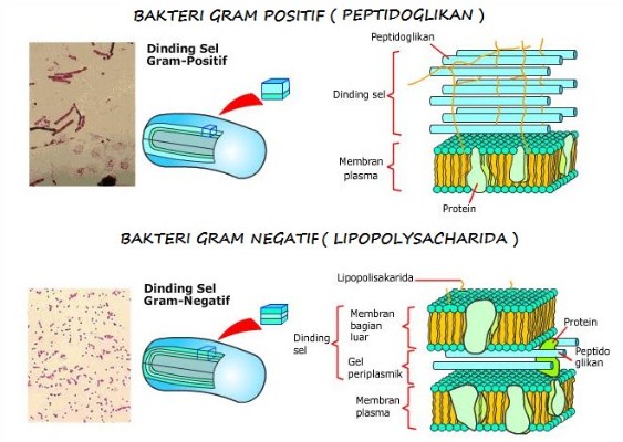 Perbedaan Bakteri Gram Positif dan Gram Negatif