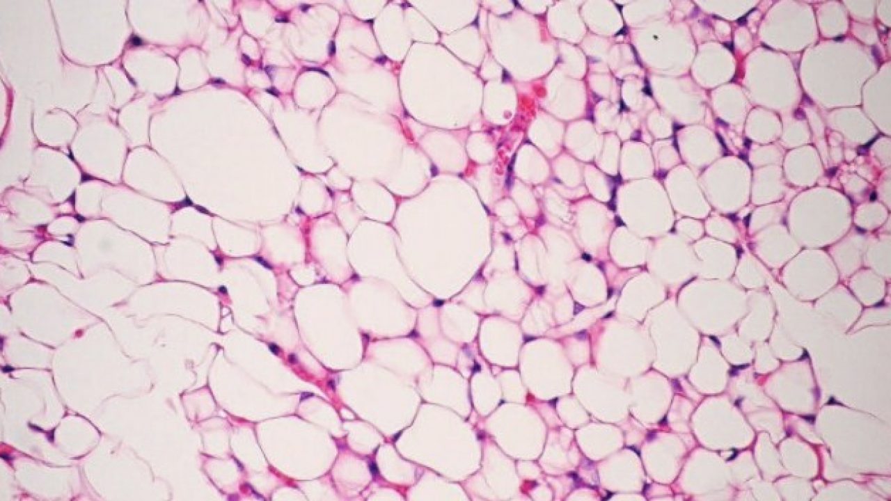 Pengertian Struktur Fungsi Dan Letak Sel Lemak Atau Sel Adiposa - Masterpendidikancom