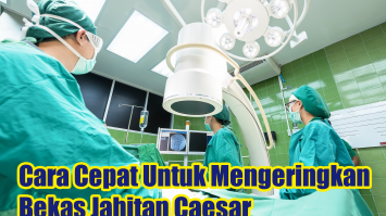 Cara Cepat Untuk Mengeringkan Bekas Jahitan Caesar